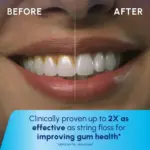 Waterpik Cordless Portable Water Flosser with 2 Tips, ADA Accepted, White and Blue - Image 2